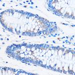COG1 Antibody in Immunohistochemistry (Paraffin) (IHC (P))