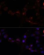 Calpain 7 Antibody in Immunocytochemistry (ICC/IF)