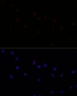 Calpain 7 Polyclonal Antibody