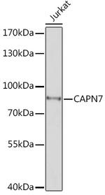 Calpain 7 Antibody in Western Blot (WB)