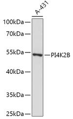 PI4K2B Polyclonal Antibody