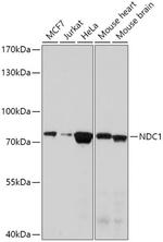 TMEM48 Polyclonal Antibody