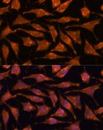 ABHD4 Polyclonal Antibody