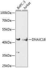 DJC18 Antibody in Western Blot (WB)