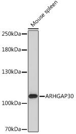 ARHGAP30 Antibody in Western Blot (WB)