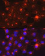 Axl Polyclonal Antibody