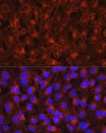Axl Antibody in Immunocytochemistry (ICC/IF)