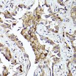 Axl Antibody in Immunohistochemistry (Paraffin) (IHC (P))