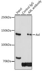 Axl Antibody in Immunoprecipitation (IP)