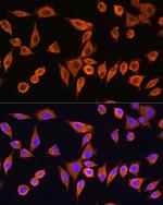 RPS28 Antibody in Immunocytochemistry (ICC/IF)