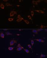 MT-ATP6 Antibody in Immunocytochemistry (ICC/IF)