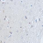 RALGDS Antibody in Immunohistochemistry (Paraffin) (IHC (P))