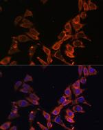 MT-ND4 Polyclonal Antibody