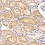 MT-ND4 Antibody in Immunohistochemistry (Paraffin) (IHC (P))
