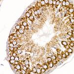 MT-ND4 Antibody in Immunohistochemistry (Paraffin) (IHC (P))