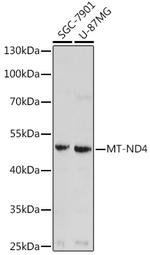 MT-ND4 Antibody in Western Blot (WB)