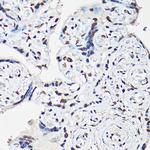 FOXO1/FOXO3/FOXO4 Polyclonal Antibody