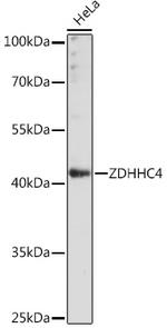 ZDHHC4 Antibody in Western Blot (WB)