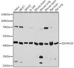 ZDHHC20 Polyclonal Antibody