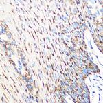 OSR1 Polyclonal Antibody