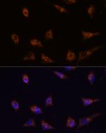 DIP2C Polyclonal Antibody