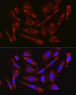 CD47 Antibody in Immunocytochemistry (ICC/IF)