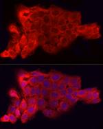 CD47 Antibody in Immunocytochemistry (ICC/IF)
