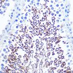 CD47 Antibody in Immunohistochemistry (Paraffin) (IHC (P))