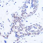 SRSF11 Antibody in Immunohistochemistry (Paraffin) (IHC (P))