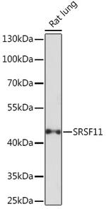 SRSF11 Antibody in Western Blot (WB)