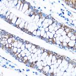 CABP1 Antibody in Immunohistochemistry (Paraffin) (IHC (P))