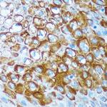 RCE1 Antibody in Immunohistochemistry (Paraffin) (IHC (P))