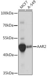 AAR2 Polyclonal Antibody