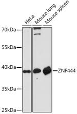 ZNF444 Polyclonal Antibody