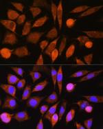 CHCHD7 Polyclonal Antibody