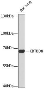 KBTBD8 Polyclonal Antibody