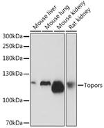 TOPORS Polyclonal Antibody