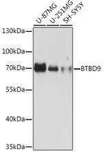 BTBD9 Polyclonal Antibody