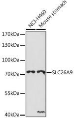 SLC26A9 Polyclonal Antibody