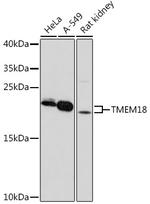 TMEM18 Polyclonal Antibody