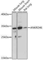 ANKRD46 Polyclonal Antibody