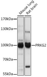 cGKII Polyclonal Antibody