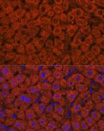 ADH1A/ADH1B/ADH1C Polyclonal Antibody