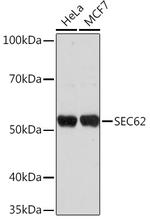 SEC62 Polyclonal Antibody