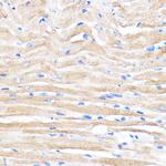 ZMPSTE24 Antibody in Immunohistochemistry (Paraffin) (IHC (P))