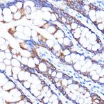 ZMPSTE24 Polyclonal Antibody