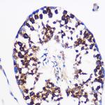 PTGES Polyclonal Antibody
