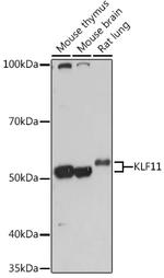 KLF11 Polyclonal Antibody