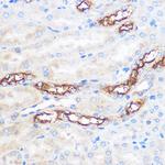 WWC2 Polyclonal Antibody