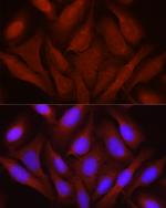 JNK1/JNK2/JNK3 Polyclonal Antibody